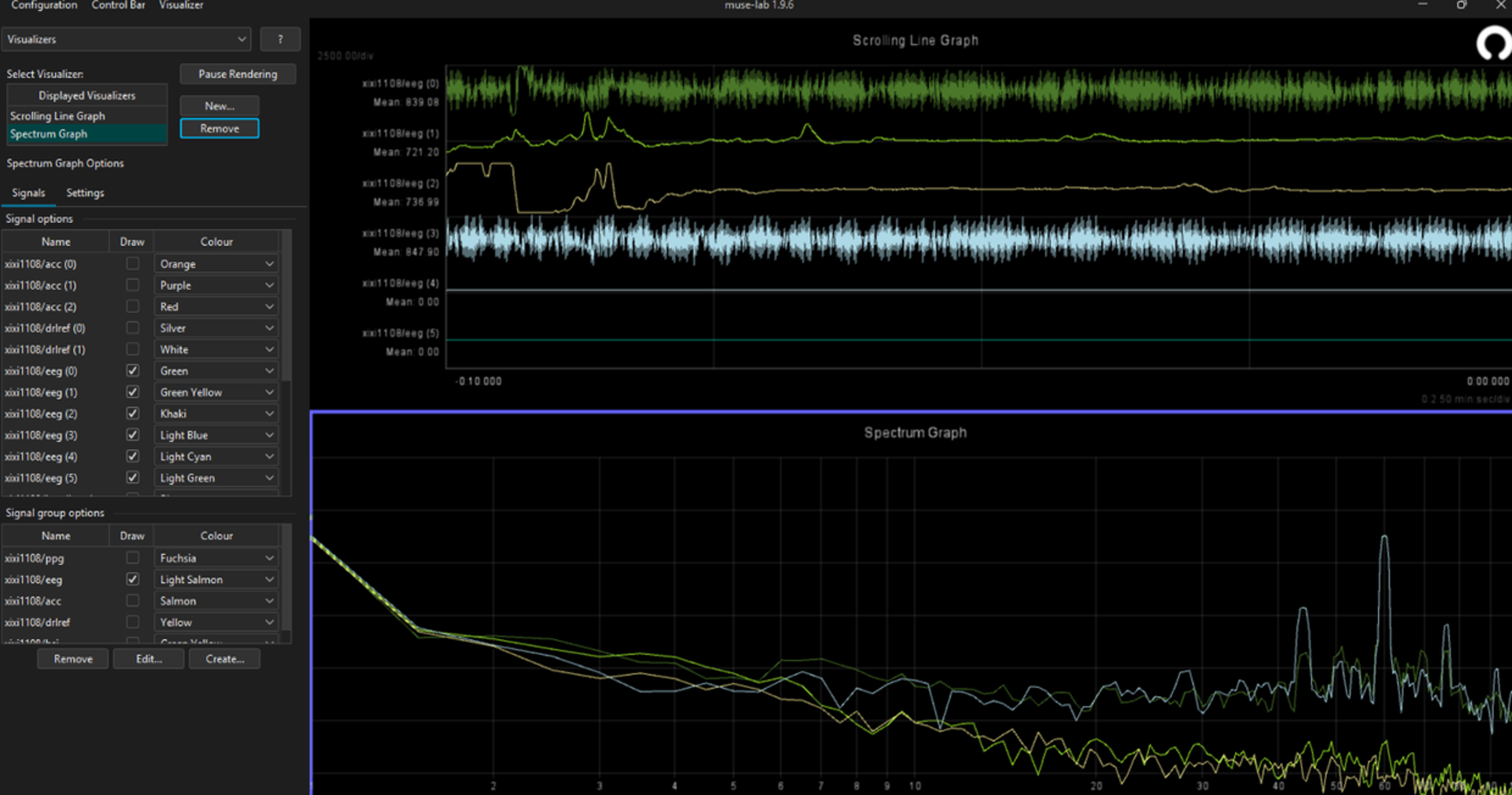 EEG signal 01