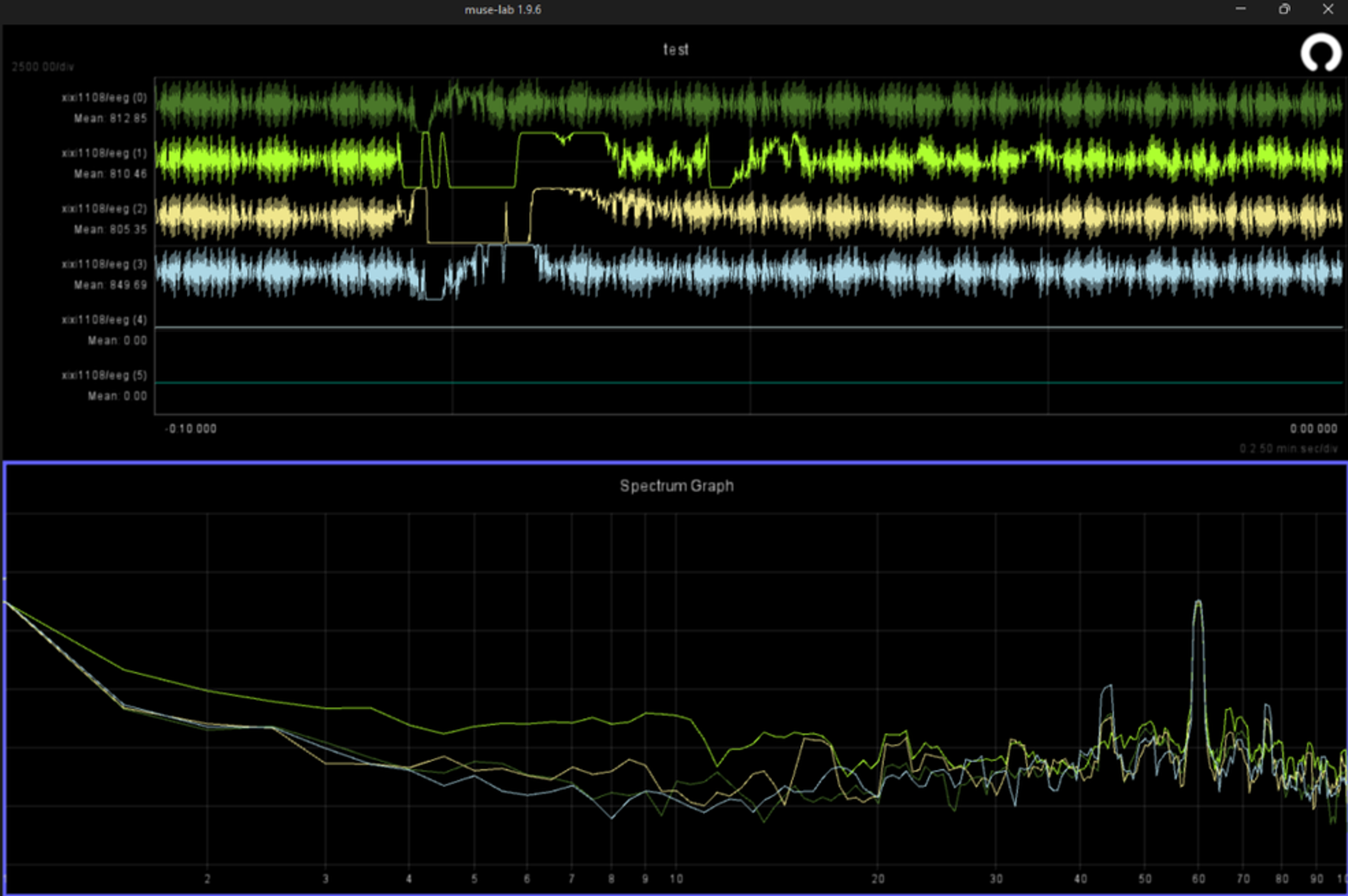 EEG signal 02