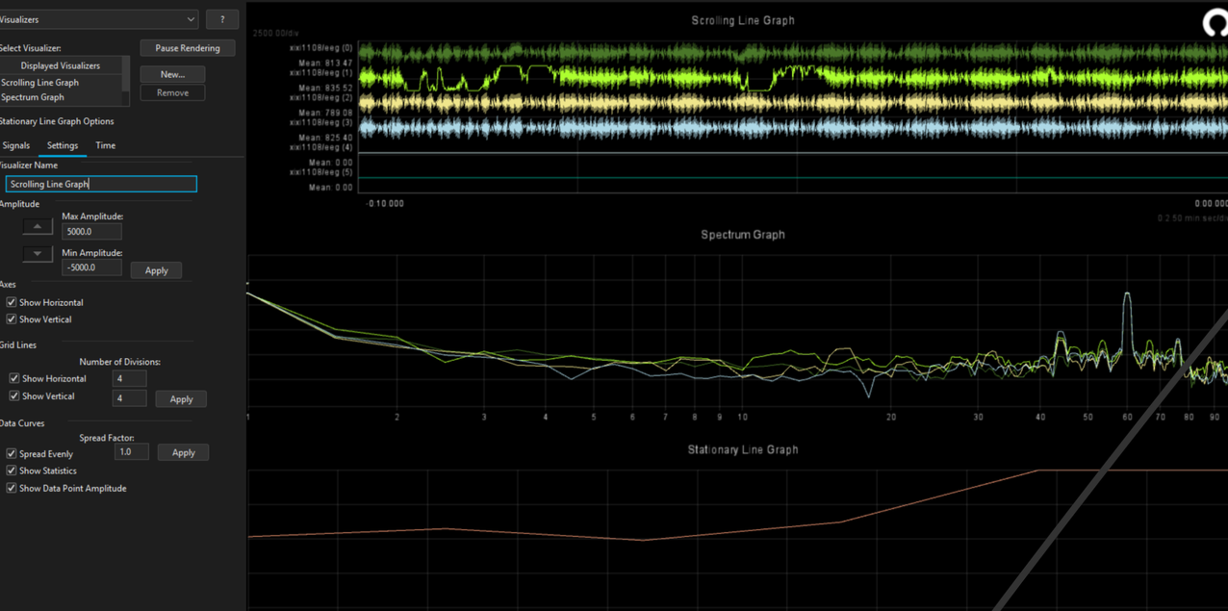 EEG signal 05