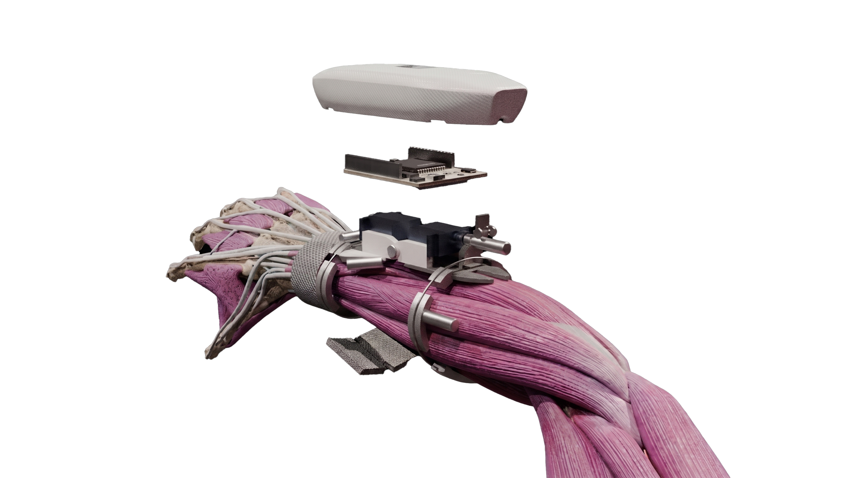 ConnectQ