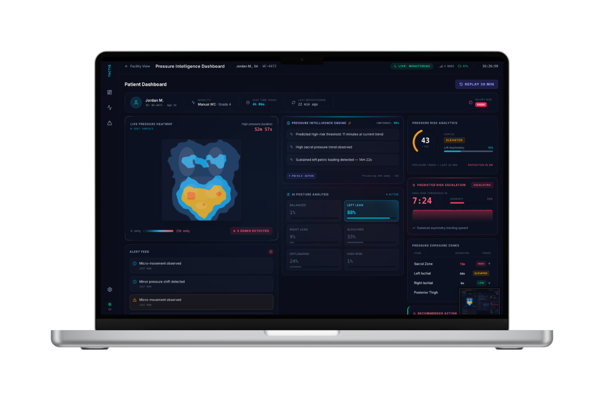 Tactiq system